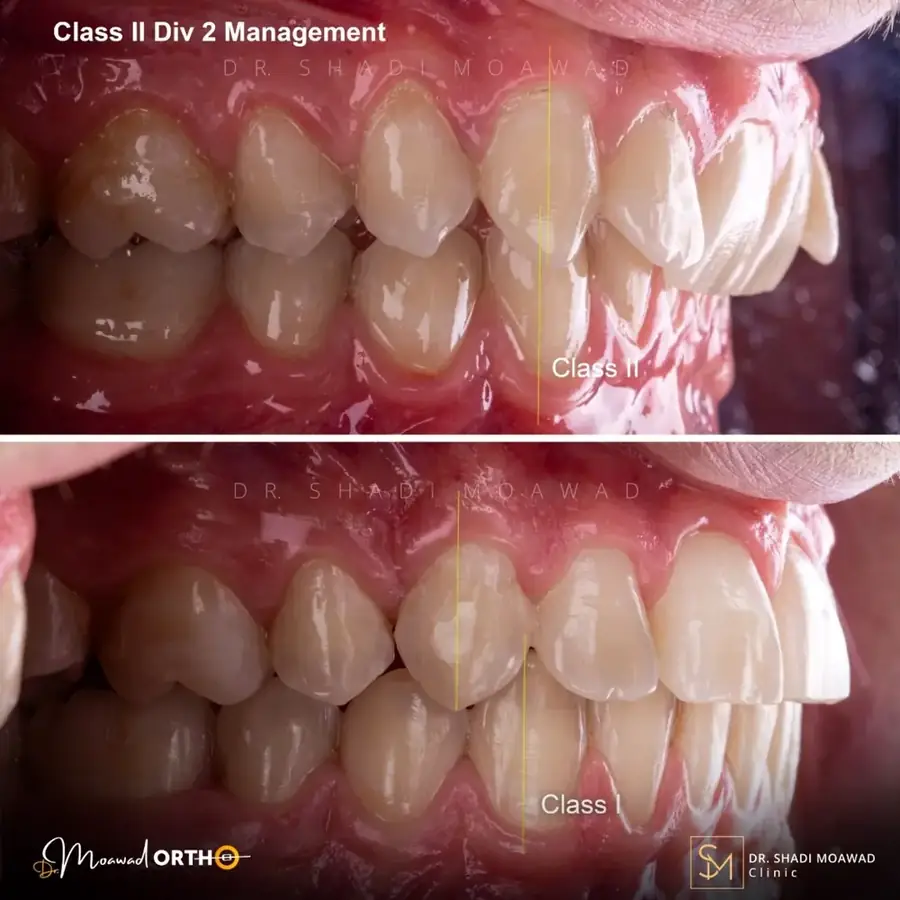 Class II Division 2 Management