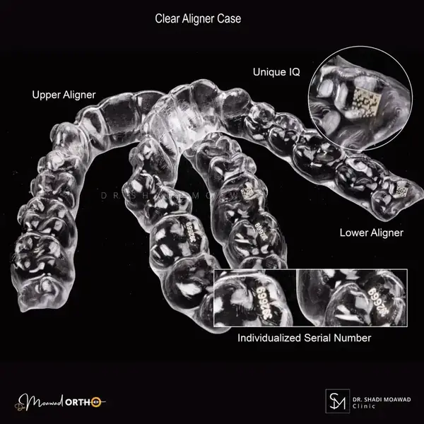 Clear Aligner Case